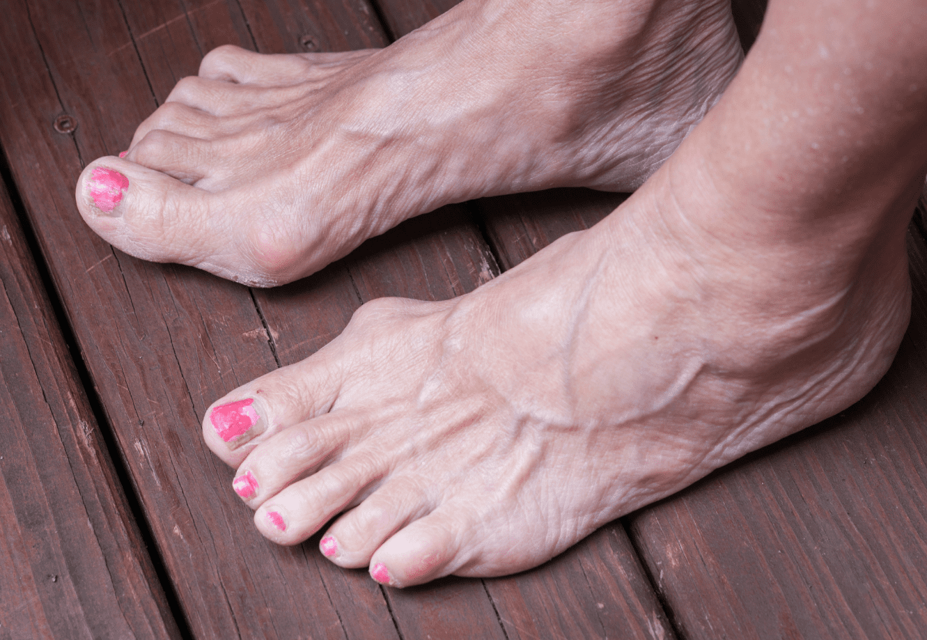 Common Foot Problems in Older Adults