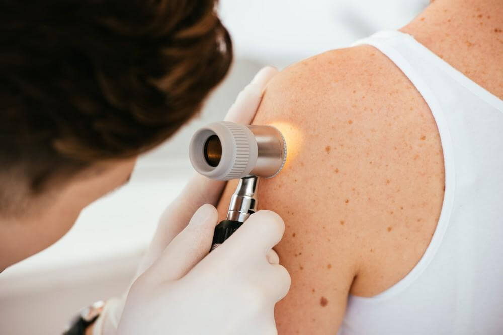 skin cancer screenings